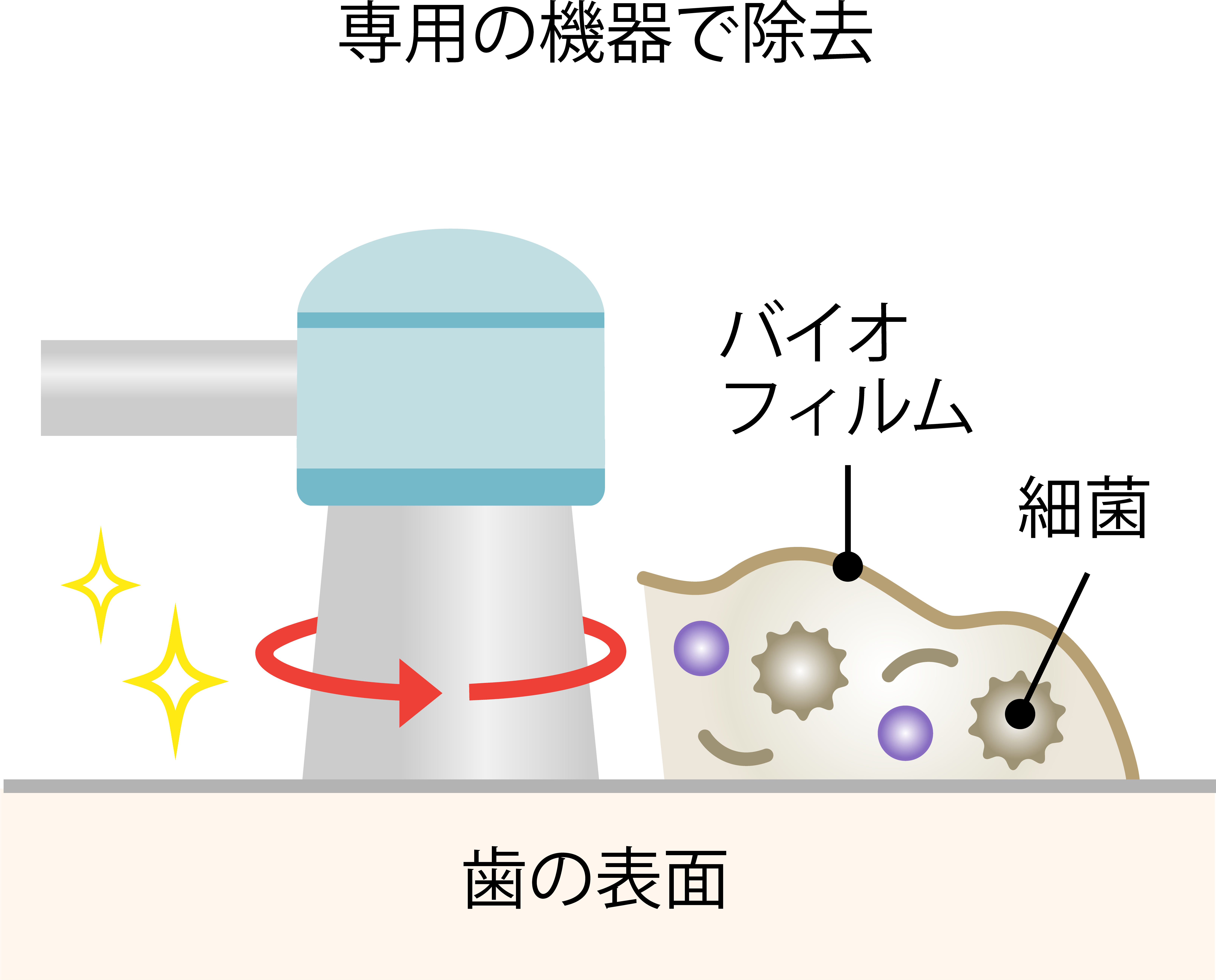 予防歯科の内容